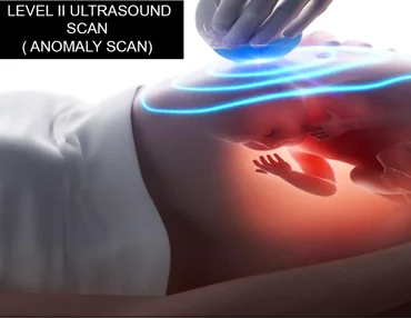 Apex:IMPORTANCE OF LEVEL II ULTRASOUND SCAN