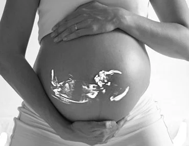 Apex:MYTHS ABOUT PREGNANCY ULTRASOUND