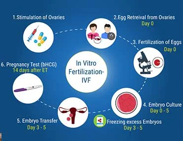 Apex:4 MYTHS ON IVF